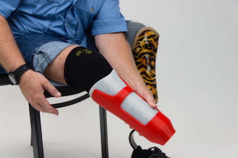 A man with a 3D printed composite prosthetic socket made on the Mark One